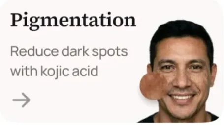 Melasma, Hyperpigmentation & De-Tan Therapy